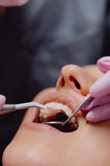 Dental Check-up
